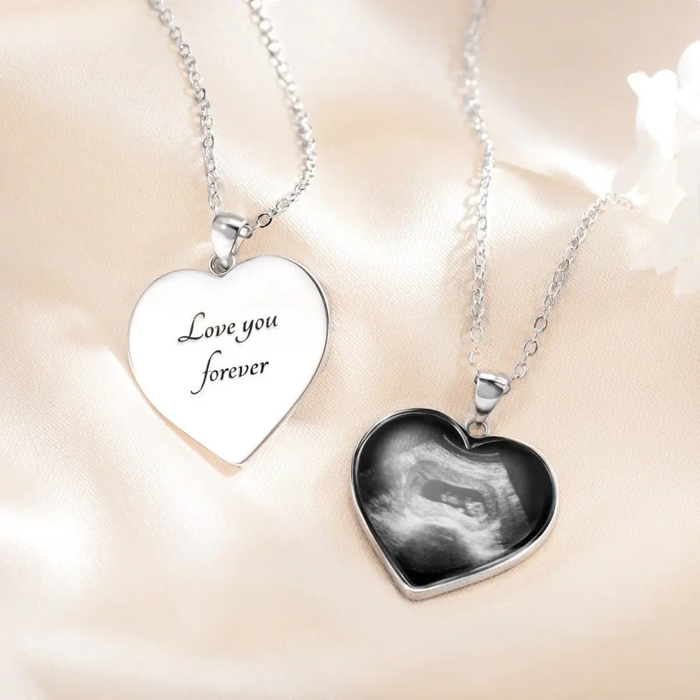 Baby Remembrance Necklace with Heart Shaped Ultrasound Image - United Bracelets